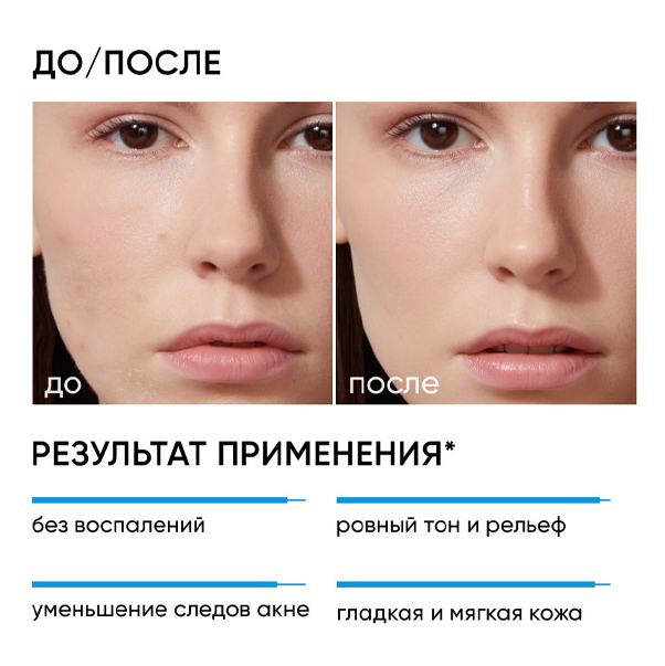RE:PROGRAM Пилинг 18% для проблемной кожи