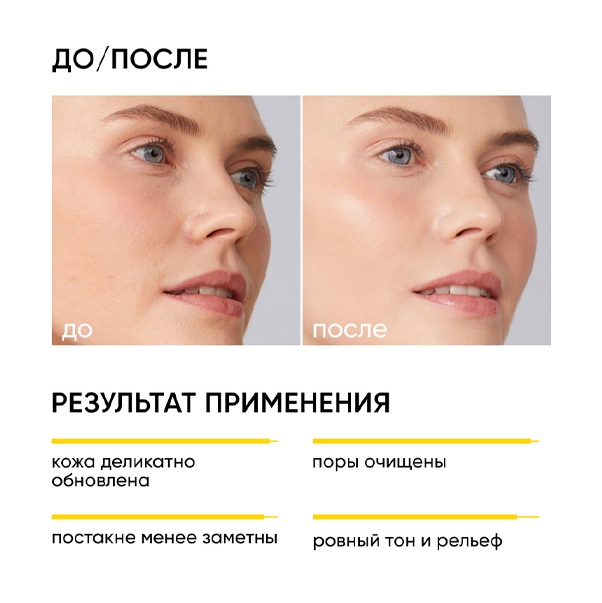 SMART SOFT RENEW Очищающий гель для умывания с кислотами