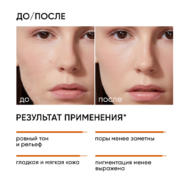 SMART 25% Интенсивный миндальный пилинг