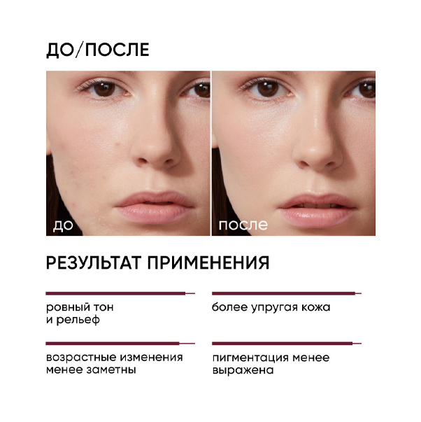 SMART 15% Омолаживающий пилинг с пептидами